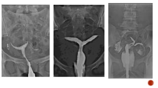 radiological procedures presentation.pptx