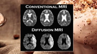 Basics of CT and MRI for Undergraduate | PPTX