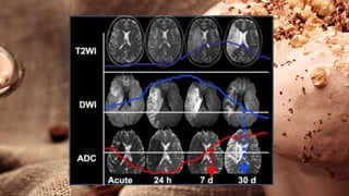 Basics of CT and MRI for Undergraduate | PPTX
