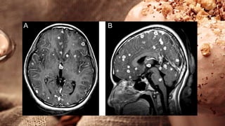 Basics of CT and MRI for Undergraduate | PPTX