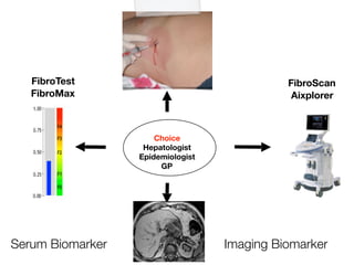 Serum Biomarker Imaging Biomarker
FibroTest
FibroMax
Choice
Hepatologist
Epidemiologist
GP
FibroScan
Aixplorer
 
