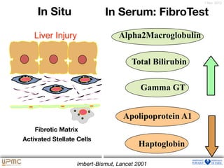 7 févr. 2012
Haptoglobin
Alpha2Macroglobulin
Apolipoprotein A1
Total Bilirubin
Gamma GT
In Situ In Serum: FibroTest
Imbert-Bismut, Lancet 2001
Liver Injury
Activated Stellate Cells
Fibrotic Matrix
 