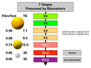 F4.1
F1
F0
F2
F3
7 Stages
Presumed by Biomarkers
Decompensated
F4.2
F4.3
Varices
FibroTest
0.48
0.74
0.85
0.95
TE
7.1
9.5
20
50
CHC Poynard J Hepatol 2014
CHB Poynard J Hepatol 2014
12.5
0.58
 