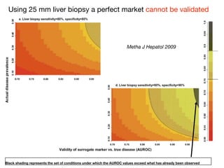 Using 25 mm liver biopsy a perfect market cannot be validated
Black shading represents the set of conditions under which the AUROC values exceed what has already been observed
Metha J Hepatol 2009
 