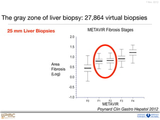 7 févr. 2012
The gray zone of liver biopsy: 27,864 virtual biopsies
Area
Fibrosis
(Log)
25 mm Liver Biopsies
Poynard Clin Gastro Hepatol 2012
 