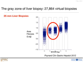 7 févr. 2012
The gray zone of liver biopsy: 27,864 virtual biopsies
Poynard Clin Gastro Hepatol 2012
Area
Fibrosis
(Log)
25 mm Liver Biopsies
 