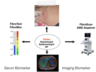 Serum Biomarker Imaging Biomarker
FibroTest
FibroMax
Choice
Hepatologist
Epidemiologist
GP
FibroScan
SWE Aixplorer
 