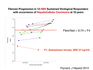 Fibrosis Progression in 13 HBV Sustained Virological Responders
with occurrence of HepatoCellular Carcinoma at 10 years
FibroTest = 0.74 = F4
Poynard, J Hepatol 2014
F1: Subsaharan female, BMI 37 kg/m2
 