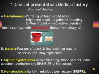 (Source of bleeding)
A.Hematemesis-Vomiting of fresh or old blood
Bright red blood --significant bleeding
Coffee ground –----no active bleeding.
(don’t confuse with Hemoptysis (bleed from pharynx)
B. Melena-Passage of black & foul smelling usually
upper source –may right colon.
C.Sign of hypovalemia-active bleeding, blood in stool, pain
abdomen,confusion and BP,HR,RR,Urine output.
D.Hematochezia (bright red blood per rectum (BRBPR).
1.Clinical presentation/Medical history
 
