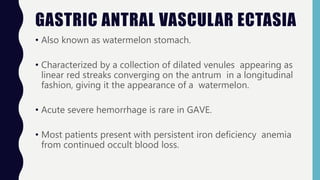 GASTRIC ANTRAL VASCULAR ECTASIA
• Also known as watermelon stomach.
• Characterized by a collection of dilated venules appearing as
linear red streaks converging on the antrum in a longitudinal
fashion, giving it the appearance of a watermelon.
• Acute severe hemorrhage is rare in GAVE.
• Most patients present with persistent iron deficiency anemia
from continued occult blood loss.
 