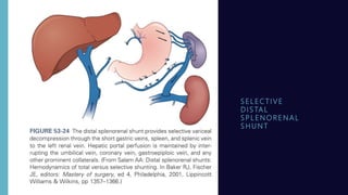 S E L E C T I V E
D I S TA L
S P L E N O R E N A L
S H U N T
 