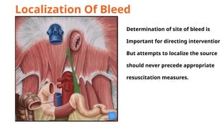 Bleeding Sources Upper Gastrointestinal BLEED presentation | PPTX
