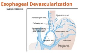 Upper Gastrointestinal BLEED presentation | PPTX