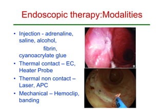 Endoscopic therapy:Modalities
• Injection - adrenaline,
saline, alcohol,
fibrin,
cyanoacrylate glue
• Thermal contact – EC,
Heater Probe
• Thermal non contact –
Laser, APC
• Mechanical – Hemoclip,
banding
 