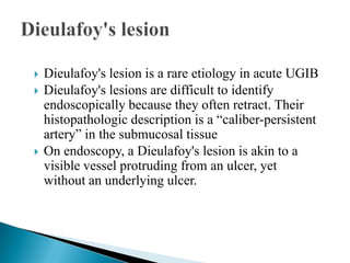 





Dieulafoy's lesion is a rare etiology in acute UGIB
Dieulafoy's lesions are difficult to identify
endoscopically because they often retract. Their
histopathologic description is a “caliber-persistent
artery” in the submucosal tissue
On endoscopy, a Dieulafoy's lesion is akin to a
visible vessel protruding from an ulcer, yet
without an underlying ulcer.

 
