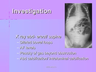 InvestigationInvestigation
 X ray abd- erect/ supineX ray abd- erect/ supine
– Dilated bowel loopsDilated bowel loops
– AF levelsAF levels
– Paucity of gas beyond obstructionPaucity of gas beyond obstruction
– Abd calcification/ intraluminal calcificationAbd calcification/ intraluminal calcification
WWW.SMSO.CCWWW.SMSO.CC
 