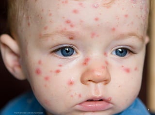 5
                                       5
PHOTO BY CHIM CHIM ON FLICKR.COM
 