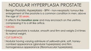 MALE GENITAL SYSTEM - PROSTATE AND TESTIS - UG PRACTICALS | PPTX