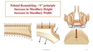 Postnatal growth of maxilla & mandible | PPTX