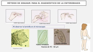 MÉTODO DE GRAHAM. PARA EL DIAGNÓSTICO DE LA ENTEROBIASIS
Huevos de 45 - 60 μm
Huevo larvado
Huevo inmaduro
Al observar la laminilla en el microscopio
 