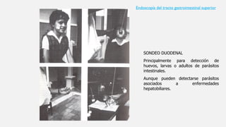 SONDEO DUODENAL
Principalmente para detección de
huevos, larvas o adultos de parásitos
intestinales.
Aunque pueden detectarse parásitos
asociados a enfermedades
hepatobiliares.
Endoscopía del tracto gastrointestinal superior
 