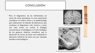 CONCLUSIÓN
• Para el diagnóstico de las helmintiasis, así
como de otras parasitosis, es muy importante
considerar el cuadro clínico y la epidemiología
para seleccionar el método de laboratorio que
conduzca al diagnóstico más certero y junto
con esto tomar en cuenta la biología,
características morfológicas y el ciclo biológico
de los gusanos. Además, considerar que la
detección de varios de estos será utilizando la
detección indirecta de estos con, por ejemplo,
estudios inmunológicos.
http://www.dge.gob.pe/publicaciones/pub_invepi/iepi0.pdf
http://www.facmed.unam.mx/deptos/familiar/atfam81/neurocisticercosis.html
 