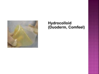 Hydrocolloid
(Duoderm, Comfeel)
 