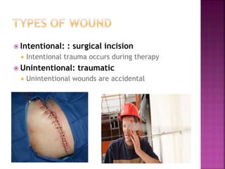  Intentional: : surgical incision
 Intentional trauma occurs during therapy
 Unintentional: traumatic
 Unintentional wounds are accidental
 