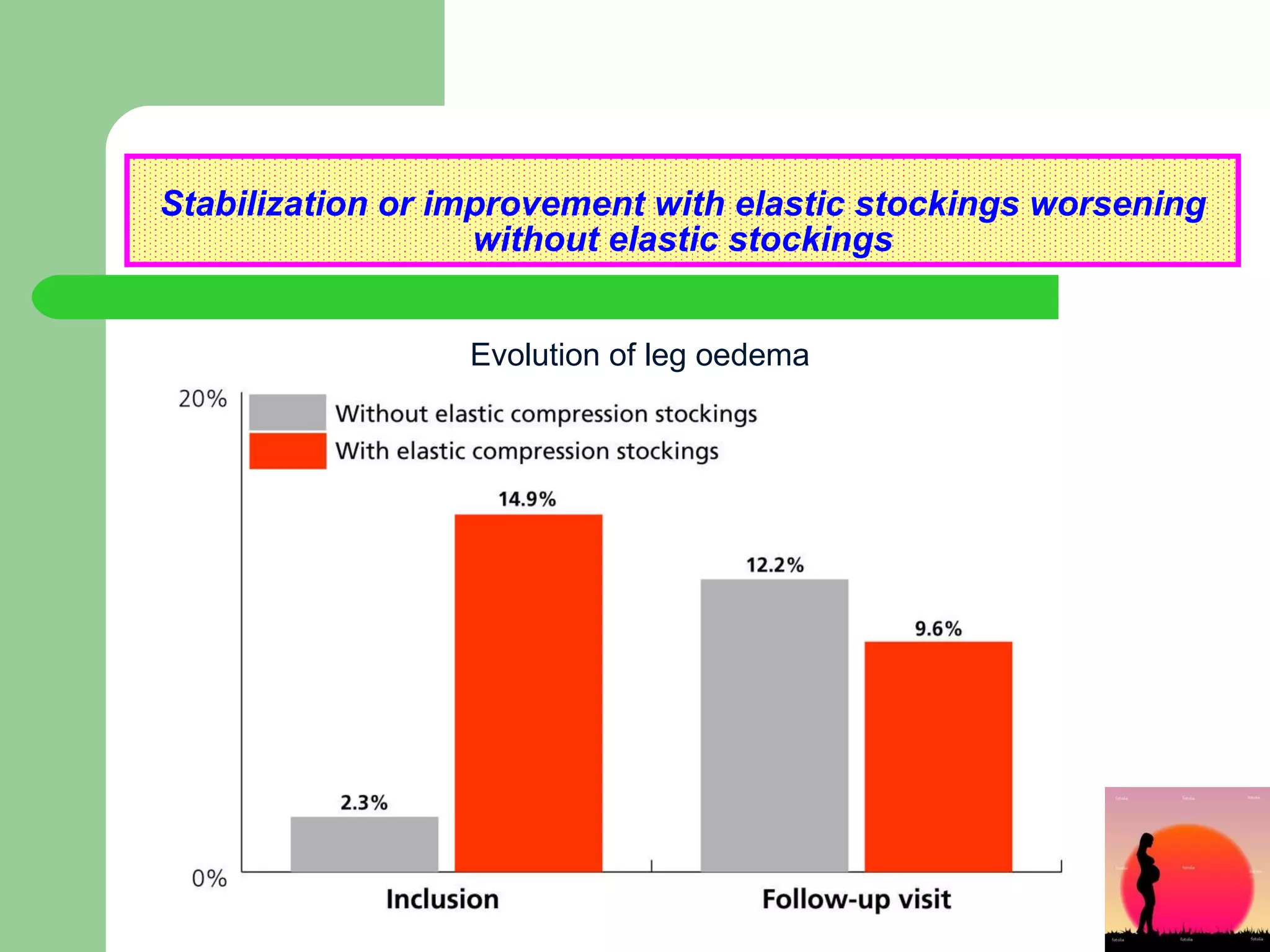 Stabilization or improvement with elastic stockings worsening without elastic stockings Evolution of leg oedema 