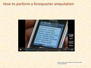 How to perform a forequarter amputation




                             Based on report in The Telegraph, 5 December 2008
                             http://goo.gl/LDRD4

                                                                                 33
 