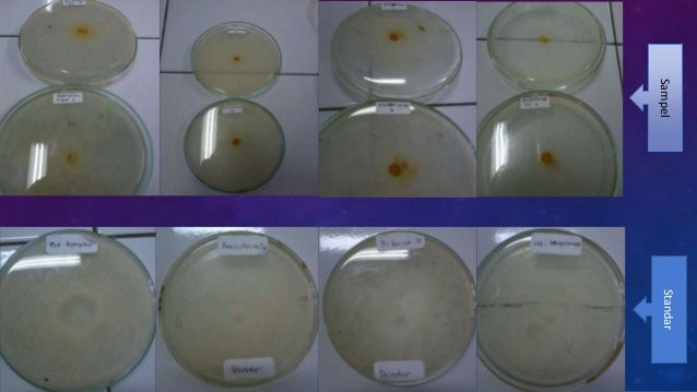 Uji aktivitas antibakteri, antijamur, antioksidan dan 