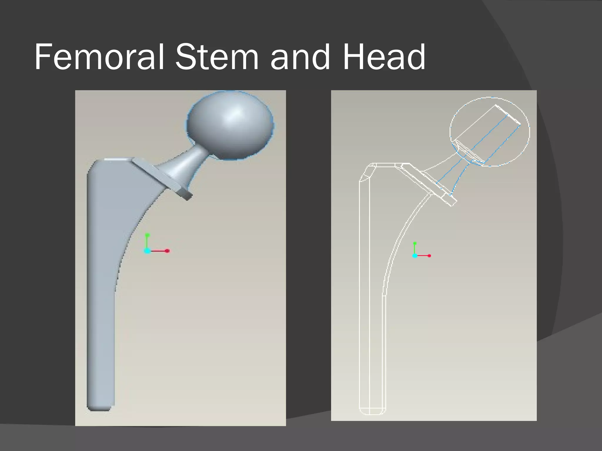 Femoral Stem and Head 