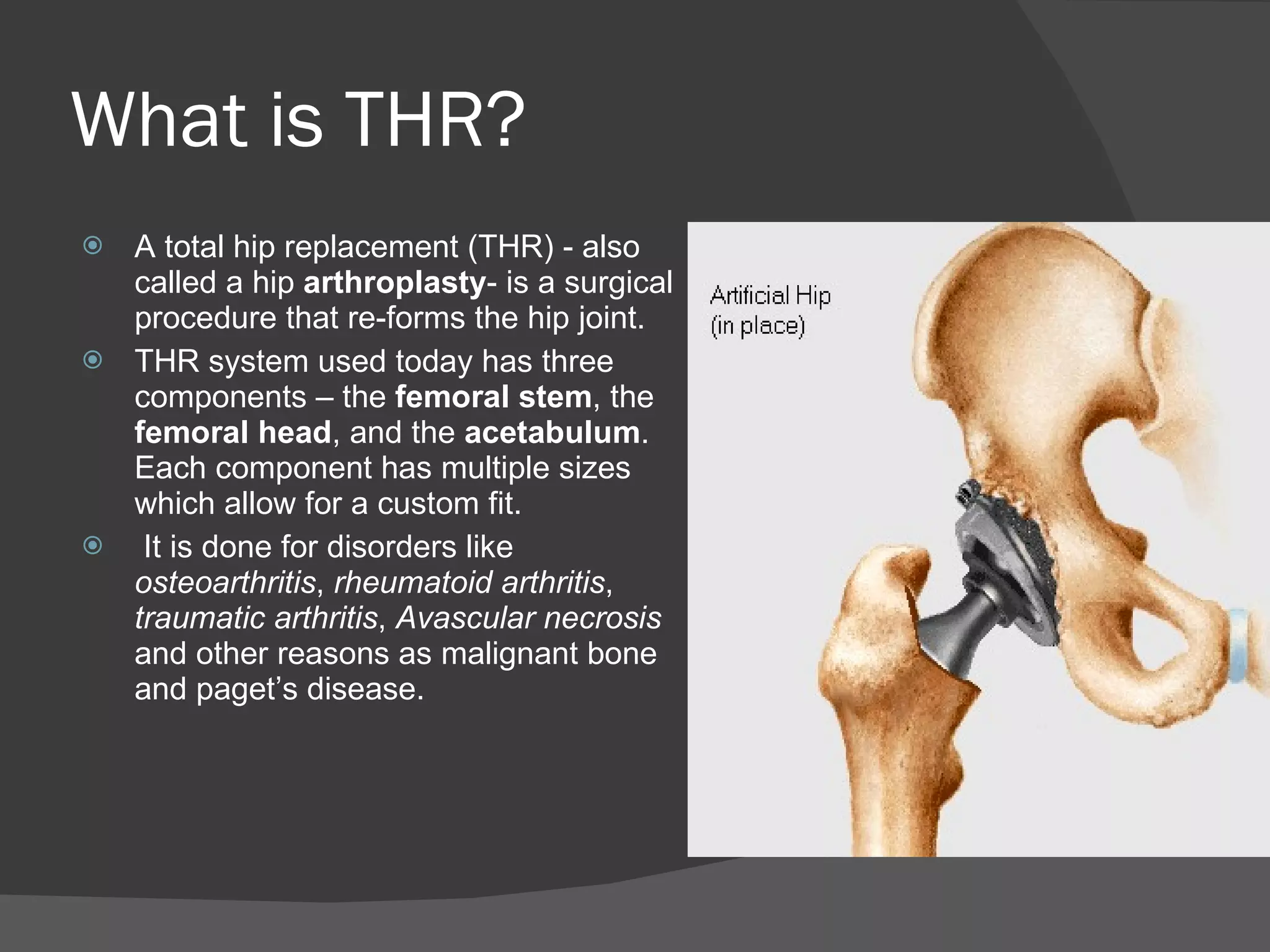 What is THR? A total hip replacement (THR) - also called a hip  arthroplasty - is a surgical procedure that re-forms the hip joint. THR system used today has three components – the  femoral stem , the  femoral head , and the  acetabulum .  Each component has multiple sizes which allow for a custom fit. It is done for disorders like  osteoarthritis ,  rheumatoid arthritis ,  traumatic arthritis ,  Avascular necrosis  and other reasons as malignant bone and paget’s disease. 
