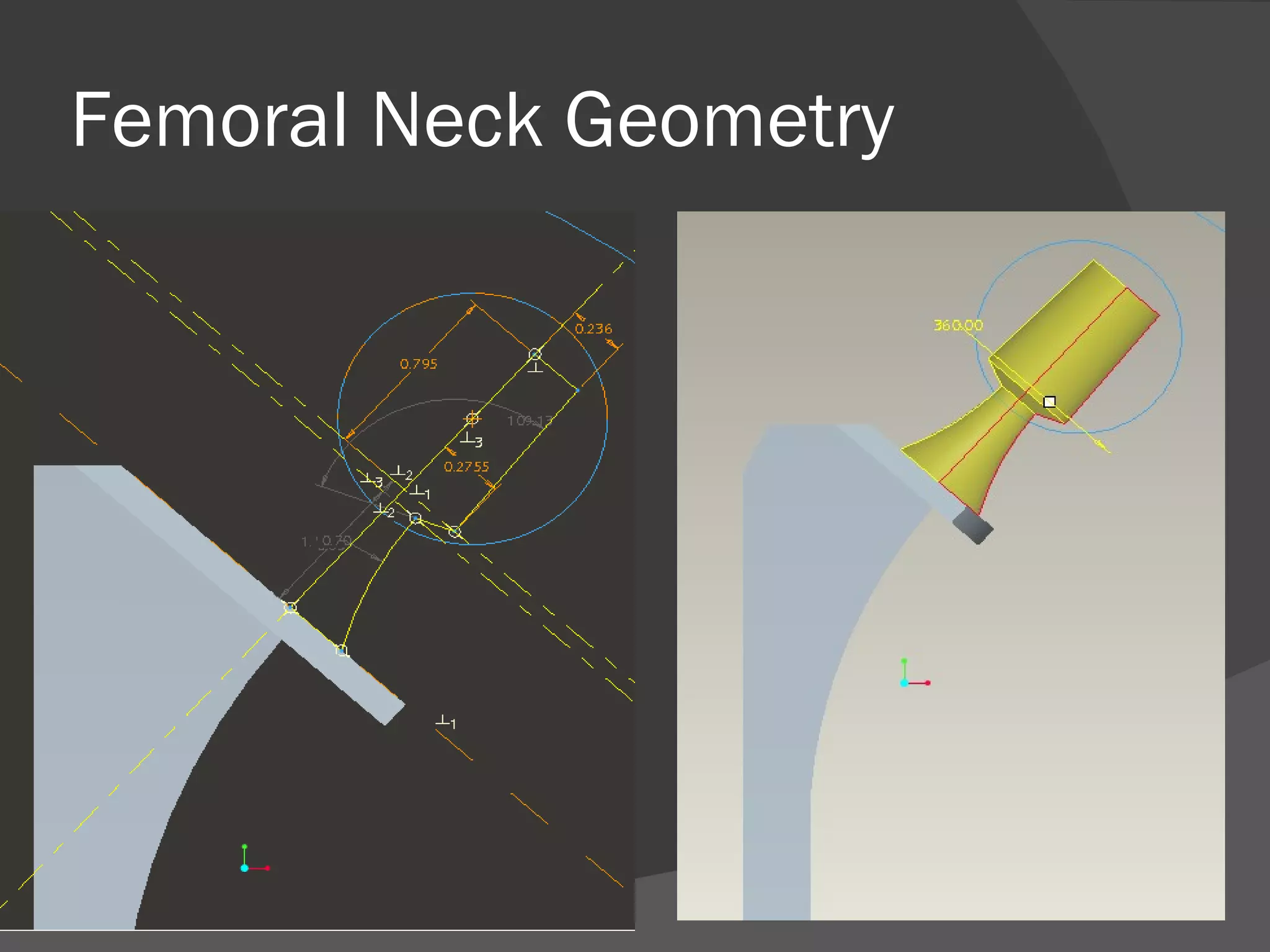 Femoral Neck Geometry 