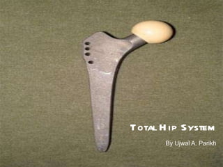 By Ujwal A. Parikh Total Hip System 