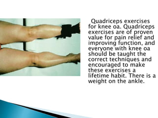 Quadriceps exercises
for knee oa. Quadriceps
exercises are of proven
value for pain relief and
improving function, and
everyone with knee oa
should be taught the
correct techniques and
encouraged to make
these exercises a
lifetime habit. There is a
weight on the ankle.
 
