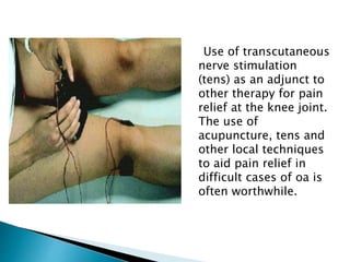 Use of transcutaneous
nerve stimulation
(tens) as an adjunct to
other therapy for pain
relief at the knee joint.
The use of
acupuncture, tens and
other local techniques
to aid pain relief in
difficult cases of oa is
often worthwhile.
 