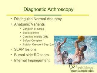 Diagnostic Arthroscopy
• Distinguish Normal Anatomy
• Anatomic Variants
• Variation of GHLs
• Sublaral Hole
• Cord-like mi...