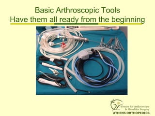 Basic Arthroscopic Tools
Have them all ready from the beginning
 