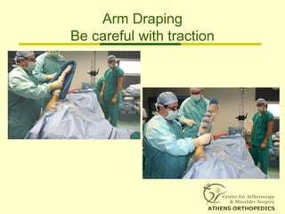 Arm Draping
Be careful with traction
 