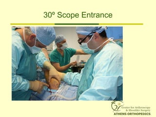 30º Scope Entrance
 