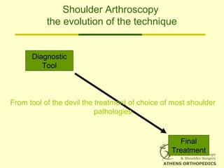 Shoulder Arthroscopy
the evolution of the technique
Diagnostic
Tool
Final
Treatment
From tool of the devil the treatment of choice of most shoulder
pathologies
 