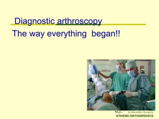 Diagnostic arthroscopy
The way everything began!!
 