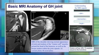Shoulder Region | PPTX