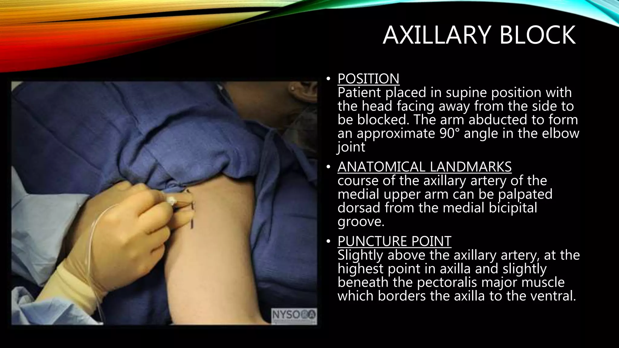 Regional Blocks of the Upper Limb and Thorax RRT | PPTX