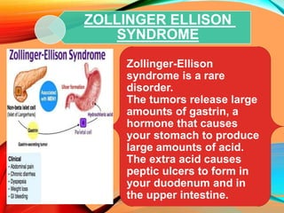 ZOLLINGER ELLISON
SYNDROME
Zollinger-Ellison
syndrome is a rare
disorder.
The tumors release large
amounts of gastrin, a
hormone that causes
your stomach to produce
large amounts of acid.
The extra acid causes
peptic ulcers to form in
your duodenum and in
the upper intestine.
 