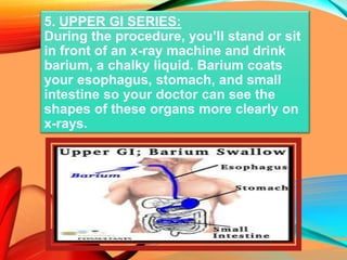 5. UPPER GI SERIES:
During the procedure, you’ll stand or sit
in front of an x-ray machine and drink
barium, a chalky liquid. Barium coats
your esophagus, stomach, and small
intestine so your doctor can see the
shapes of these organs more clearly on
x-rays.
 