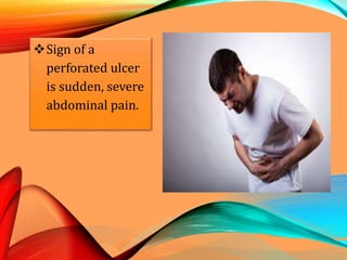 Sign of a
perforated ulcer
is sudden, severe
abdominal pain.
 