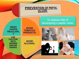 AVOID
TOBACCO
PRODUCTS
AVOID
ALCOHOL
USE
CAUTION
WITH
ASPIRIN
AND/OR
NSAIDS
WASH
HANDS
REGULARL
Y
To reduce risk of
developing a peptic ulcer,
 