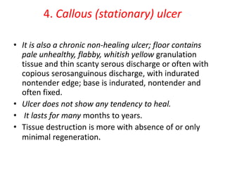 4. Callous (stationary) ulcer
• It is also a chronic non-healing ulcer; floor contains
pale unhealthy, flabby, whitish yellow granulation
tissue and thin scanty serous discharge or often with
copious serosanguinous discharge, with indurated
nontender edge; base is indurated, nontender and
often fixed.
• Ulcer does not show any tendency to heal.
• It lasts for many months to years.
• Tissue destruction is more with absence of or only
minimal regeneration.
 